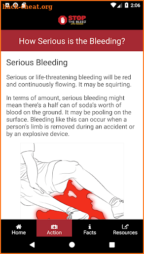 Stop the Bleed screenshot