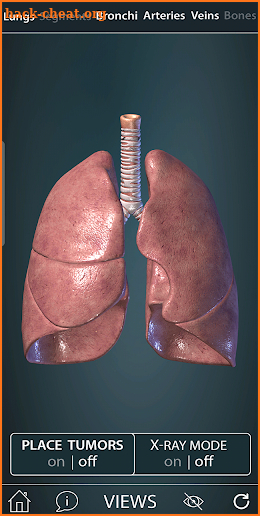 Surgical Anatomy of the Lung screenshot