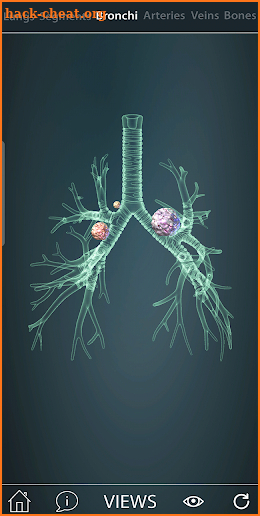 Surgical Anatomy of the Lung screenshot