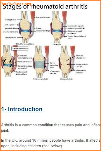 Symptoms and Treatment of top 40 diseases screenshot