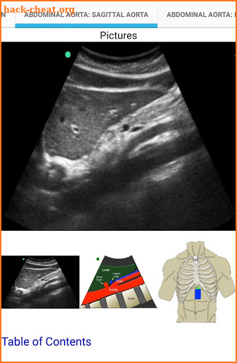 The Emergency Ultrasound Handbook screenshot