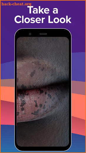 Top Derm: A game for dermatologists screenshot