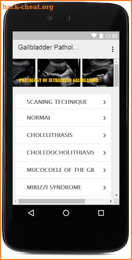 ULTRASOUND GALLBLADDER AND PHATOLOGY screenshot