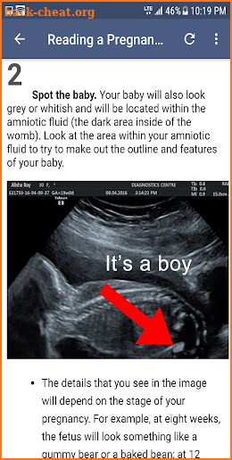 Ultrasound Guide screenshot