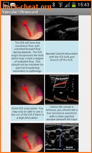 Vascular Ultrasound screenshot