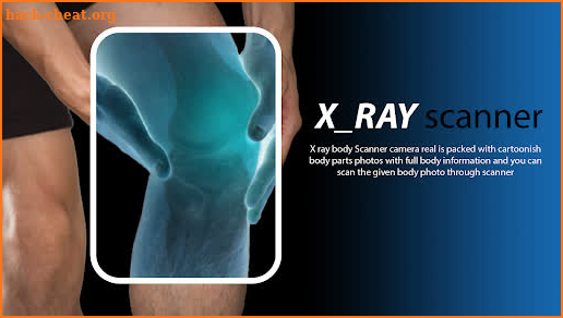 X ray scanner body real camera screenshot