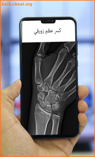 xray screenshot