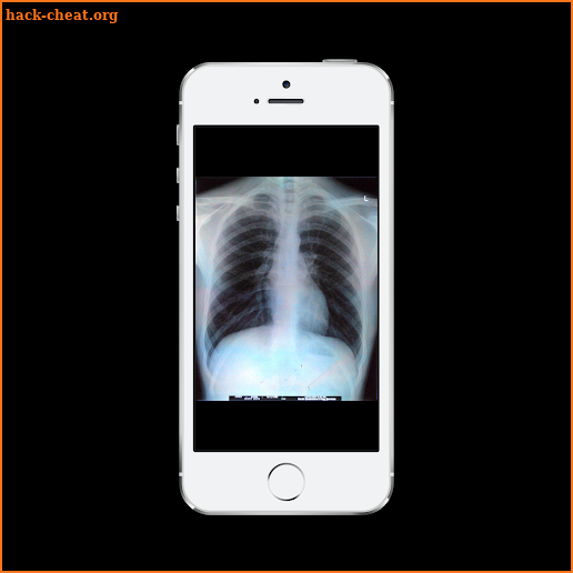 Xray Scanner screenshot