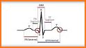 Electrocardiogram ECG Types related image