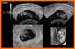 Ultrasound for pregnancy related image