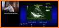 Basic Principles of Doppler Ultrasound related image