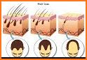 Baldness Thinning Hair related image