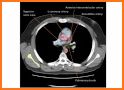 CT Scan Cross Sectional Anatomy related image