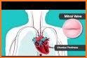 Heart Murmurs related image