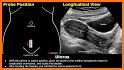 Obstetrics & Gyenacology Ultrasound Guide related image