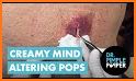 Crazy Popping related image