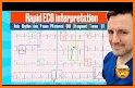 ECG Interpretation: Pkt Guide related image