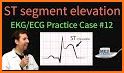 ECG 100 Clinical Cases related image