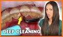 Teeth Cleaner related image