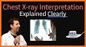 X-ray Interpretation for Medical Use related image