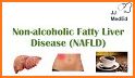 Fatty Liver (NAFL) related image