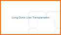 Liver Transplant Education related image