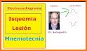 Electrocardiograma ECG Tipos related image