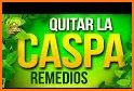 Como Quitar La Caspa Remedios Para La Caspa related image