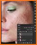 Blemish Remover Photo Editor related image