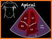 Videos for POCUS: Point-of-Care Ultrasound related image