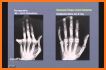 Interpret Chest X-Ray With 100 Cases related image