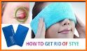 How To Treat A Stye related image