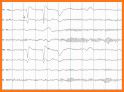 EEG Tutorial related image