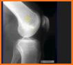 Musculoskeletal X- Rays Interpretation related image