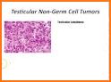 Pathology in Practice (USMLE) related image