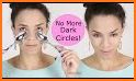 Get Rid Of Dark Circles Under Eyes related image