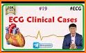 Medicos ECG :Clinical Guide & Daily EKG/ ECG Cases related image