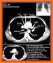 CT Passport Chest / sectional anatomy / MRI related image