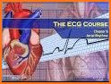 ECG Rhythm related image