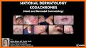 Pediatric Dermatology DDx Deck, 2nd Edition related image