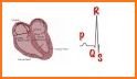 ECG Basics - Full related image