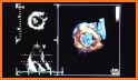 Echocardiography pocketcards related image