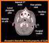 CT Scan Cross Sectional Anatomy related image