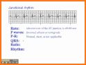 ACLS Rhythm Tutor related image