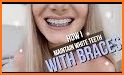 Cleaning Tips with Braces related image