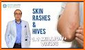 Skin Rash Cure related image