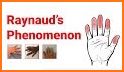 Raynaud related image