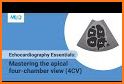 Echocardiography 2e related image