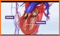 Atrial Fibrillation Risk - Stroke, TIA, Embolism related image