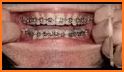 Braces Photo Editor related image